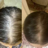 این درمان با بقیه فرق داره