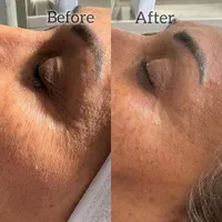 آفر ویژه آموزش وخدمات تخصصی پاکسازی، فیشال(فیشیال)|خدمات آرایشگری و زیبایی|قم, باجک یک|دیوار
