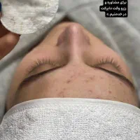 فشیال و پاکسازی پوست رایگان