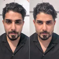 فیلر بادی ژل لب بوتاکس نخ لیفت فیلر بینی آنزیم لب|خدمات آرایشگری و زیبایی|اصفهان, باغ نگاره|دیوار
