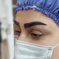 کاشت ابرو طبیعی