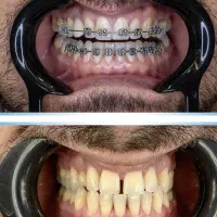 شرایط اقساطی خدمات دندانپزشکی ایمپلنت،ارتودنسی،|خدمات آرایشگری و زیبایی|جلفا, |دیوار