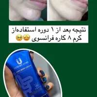 برندلاکچری کوین،گاتیو،ویتابلا|آرایشی، بهداشتی، درمانی|کیش, |دیوار