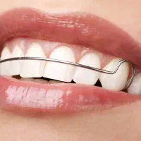 سیم پیچی ( ارتودنسی) دندان کودکان