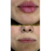 هدیه روز مادر آف ژل وبوتاکس|خدمات آرایشگری و زیبایی|ایذه, |دیوار