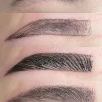 میکروبلیدینگ وشیدینگ لب