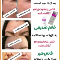 کرم بوتاکس صورت|آرایشی، بهداشتی، درمانی|اهواز, کیان اباد|دیوار