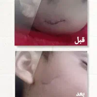 درمان پوست ومو|آرایشی، بهداشتی، درمانی|نهبندان, |دیوار