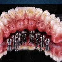 نیازمند نیروی لابراتوار دندانسازی خانم