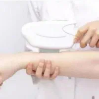 لیزر موهای زائد