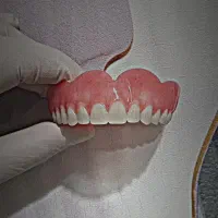 دندانسازی ((دندان مصنوعی))|خدمات آرایشگری و زیبایی|ارومیه, |دیوار