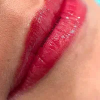 فیبروز میکروبلیدینگ شیدینگ