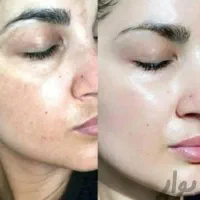 کرم سوپر معجزه صدرصد اصلی و ضمانتی|آرایشی، بهداشتی، درمانی|سنندج, |دیوار