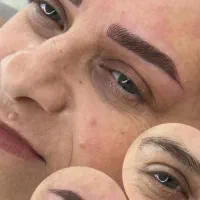 آف بلیدینگ فیبروز بلدبروز