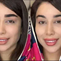 تغییر چهره با میکروبلیدینگ یک جلسة|خدمات آرایشگری و زیبایی|مشهد, بهار|دیوار