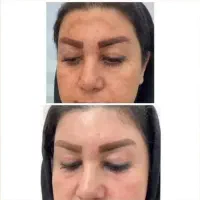 جوانسازی و شفافیت پوست