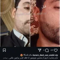کرم معجزه صورت کرم عربی دست و پا
