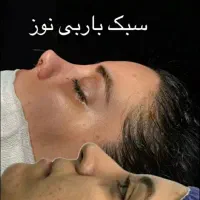 عمل بینی آف عیدانه  از ۲۴ میلیون  بمدت محدود