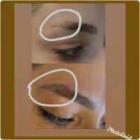 پاک کردن تتو