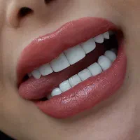 تخفیف ویژه کامپوزیت زیبایی و دندانپزشکی|خدمات آرایشگری و زیبایی|کرج, شاهین‌ویلا|دیوار