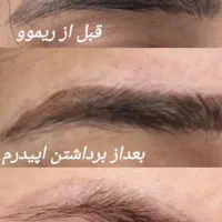 مرکز تخصصی ریموو وآرایش دائم فرشته سوداگران|خدمات زیبایی و سلامت|تهران, فدک|دیوار