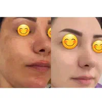 کرم ضد لک روشن کننده قوی گلدن کویین|آرایشی، بهداشتی، درمانی|شیراز, اصلاح‌نژاد|دیوار