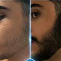 احیای مو ترکیبی موثر