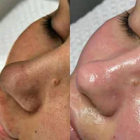 فیلر ، بوتاکس ، فیشال ، لیزر ، پی آر پی|خدمات آرایشگری و زیبایی|اندیشه, اندیشه فاز ۱|دیوار