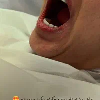 دندانپزشکی خیریه کامپوزیت 600 ، ایمپلنت با روکش 9|خدمات آرایشگری و زیبایی|تهران, تجریش|دیوار