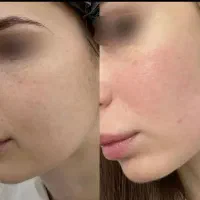 کرم لک|آرایشی، بهداشتی، درمانی|اهواز, دغاغله|دیوار
