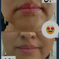 روتین پوستی مهلران|خدمات آموزشی|احمدآبادمستوفی, |دیوار