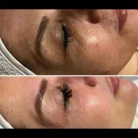 جوانسازی ،درمان پوست ،فیشال،پاکسازی،پوست کره ای|خدمات آرایشگری و زیبایی|شیراز, قدوسی غربی|دیوار