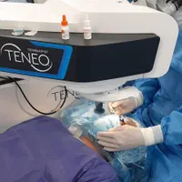 تضمین برداشتن دائمی عینک، تخصصی چشم