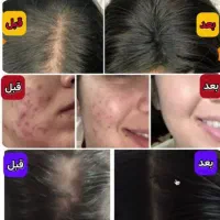 پوستت روزیباترکن