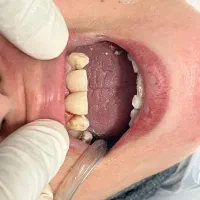 دندانپزشکی اطفال و بزرگسال|خدمات آرایشگری و زیبایی|رشت, پل تالشان|دیوار