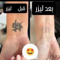 کلینیک تخصصی پاک کردن تتو با لیزر تضمینی/ریمو ابرو|خدمات آرایشگری و زیبایی|مشهد, کوثر|دیوار