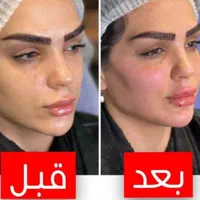 جشنواره  تزریق چربی لیزر لاغری ژل بوتاکس|خدمات آرایشگری و زیبایی|تهران, هفت حوض|دیوار