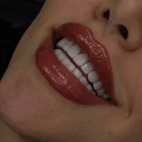 خدمات زیبایی و درمانی با تخفیف ویژه شرایط موجود