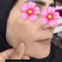 کرم ژل رویال بهترین ضدلک|آرایشی، بهداشتی، درمانی|قم, امامزاده ابراهیم|دیوار