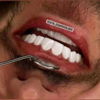 چشنواره‌پاییزه‌کامپوزیت‌ولمینت‌دندان‌