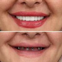 خدمات تخصصی دندانپزشکی ، ایمپلنت ،زیبایی