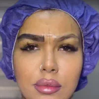 کاشت مووابرو با تخفیف درکلینیک تخصصی تبریز|خدمات آرایشگری و زیبایی|اردبیل, |دیوار