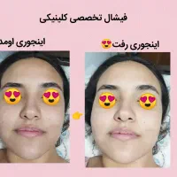 پاکسازی و روشن سازی vip عروس