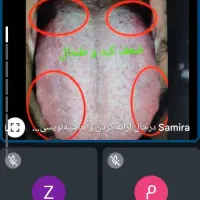 آموزش زبان‌شناسی، مزاج شناسی درمنزل