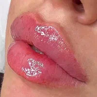 خدمات ژل و بوتاکس ، مزوتراپی سر و صورت|خدمات آرایشگری و زیبایی|شاهینشهر, فردوسی|دیوار