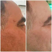 لاغری شکم پهلو ران بازو مزو مو مزو غبغب لیفت سینه|خدمات آرایشگری و زیبایی|تهران, سبلان (لشگر)|دیوار