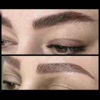 میکروبلیدینگ و فیبروز ابرو