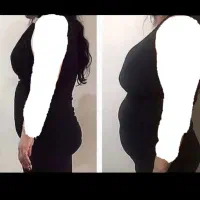 کلینیک تخصصی لاغری بدون بازگشت