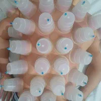 حجامت معجزه میکنه|آرایشی، بهداشتی، درمانی|بندر کنگان, |دیوار