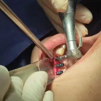 اقساط دندانپزشکی بدون پرداخت پول کلیه خدمات|خدمات آرایشگری و زیبایی|اصفهان, دشتستان|دیوار